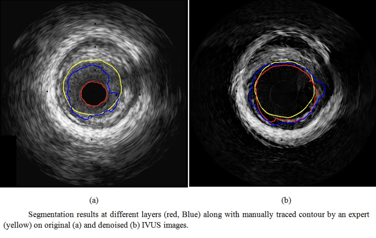 Figure 15
