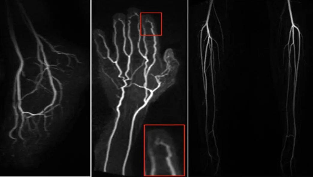 Figure 18